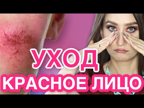 Видео: КУПЕРОЗ и РОЗАЦЕА 🟥 Уход при красноте кожи 😬
