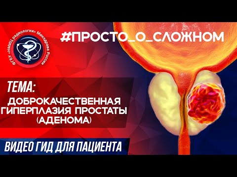 Видео: #ПРОСТО_о_СЛОЖНОМ Доброкачественная гиперплазия простаты (аденома)