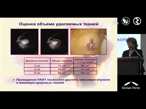 Видео: Неоадъювантная химиотерапия: клиническая и патоморфологическая оценка ответа