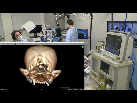 Видео: Удаление инородного тела из носа. У собак нет простуды