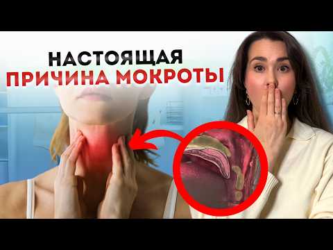 Видео: У вас больше НИКОГДА не будет СЛИЗИ В ГОРЛЕ | Совет врача как избавиться от мокроты в горле и ГЭРБ