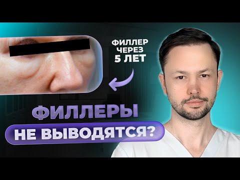 Видео: Отекшие лица. Филлеры остаются навсегда?