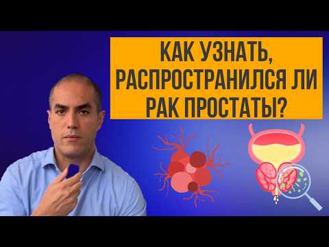Видео: Как узнать, распространился ли рак простаты?