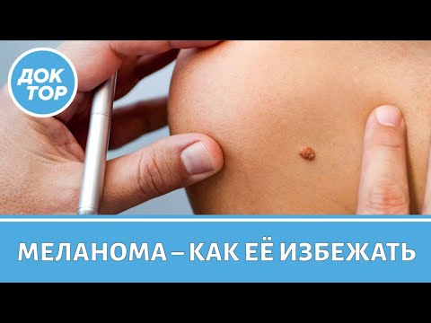 Видео: Как избежать меланомы и как ее вовремя обнаружить