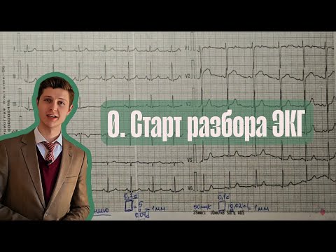 Видео: Алгоритм анализа ЭКГ | 0. Старт разбора