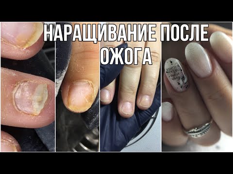 Видео: Наращивание после химическиго ожага// А может не стоило