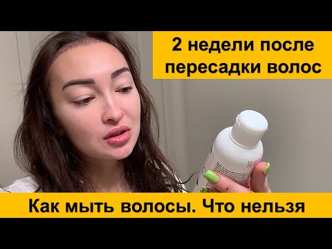 Видео: 2 недели после пересадки (трансплантации) волос у женщины