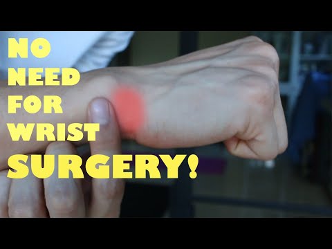 Видео: Боль в запястье устраняется за 6 минут | Боль в запястье со стороны детского пальца | Физиотерапи...