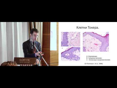 Видео: Рак Педжета: взгляд морфолога