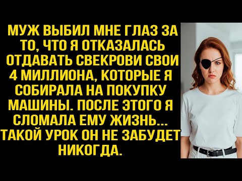 Видео: Муж выбил мне глаз, требуя отдать свекрови мои 4 млн на машину