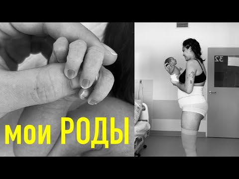 Видео: 8. мои РОДЫ. экстренное кесарево. СРД. платные роды ЦПСиР