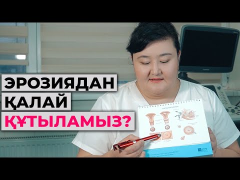 Видео: Эрозияны қалай емдейміз? Күйдіру керек па? Емдеу керек па?