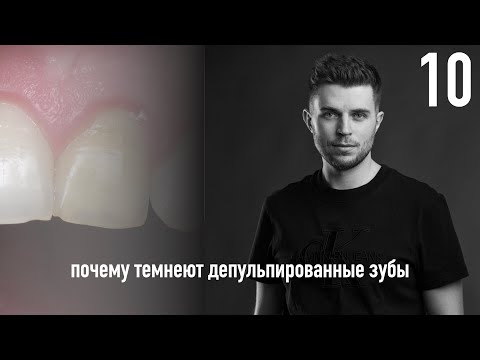 Видео: Уроки эндодонтии. Почему темнеют депульпированные зубы