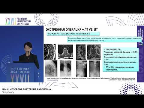 Видео: Костные метастазы: когда от лучевой терапии лучше воздержаться?