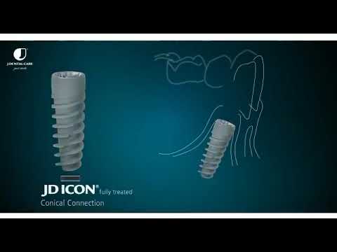 Видео: Виды имплантатов из Италии JDENTAL