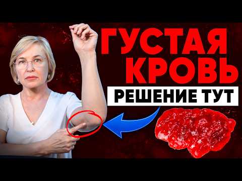 Видео: Разжижение крови — профилактика давления и варикоза. 3 простые точки