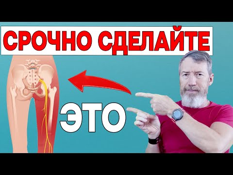 Видео: Защемило Седалищный Нерв? Срочно СДЕЛАЙТЕ эти 5 Упражнений и БОЛЬ пройдет