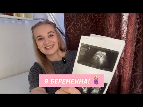 Видео: Я беременна! 🩷🤰🏼Беременность после ЗБ // Какой срок? Кого ждём?