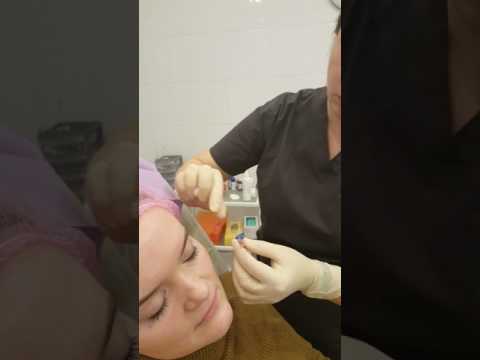 Видео: Диспорт - Глаза. Убираем мимические морщины, гусиные лапки вокруг глаз