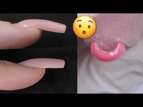 Видео: Ноготь растет ВНИЗ | Коррекция ногтей ГЕЛЕМ
