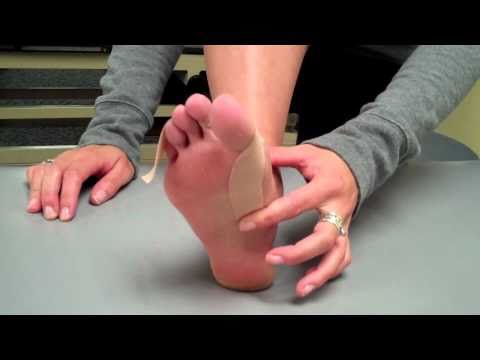 Видео: Тейпирование Hallux Rigidus Spica: также для Hallux Limitus, бурситов, торфяных пальцев ног.