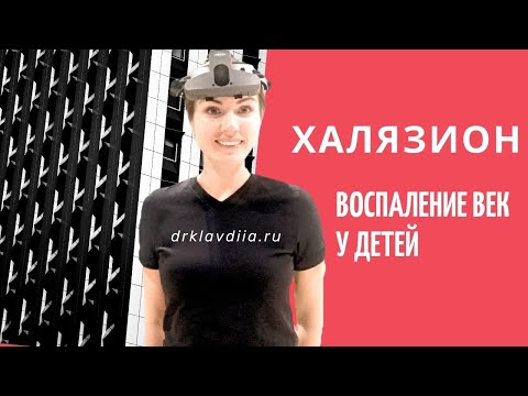 Видео: Халязион: воспаление век у детей