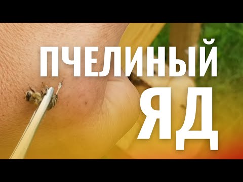 Видео: ПЧЕЛИНЫЙ ЯД. МОЙ ЛИЧНЫЙ ОПЫТ ПЧЕЛОУЖАЛИВАНИЯ