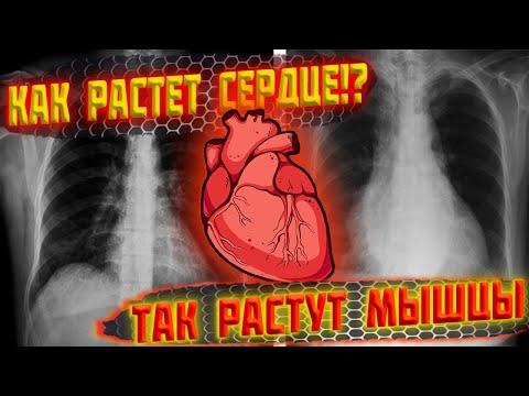 Видео: Как растет сердце!? Так растут мышцы...