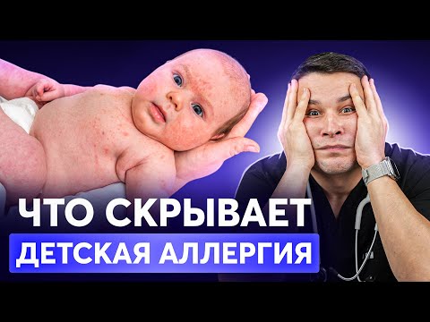 Видео: Вылечите АЛЛЕРГИЮ у ребенка раз и НАВСЕГДА! Главные мифы, которые вредят ЗДОРОВЬЮ малыша