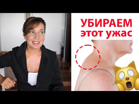 Видео: Как убрать ХОЛКУ и улучшить ОВАЛ лица  ✦ Самый простой способ