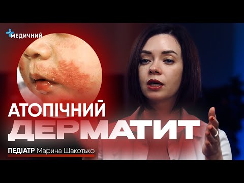 Видео: ТОП запитань педіатру: «невиліковна» хвороба, вакцинація, гормональна терапія, заборона на купання