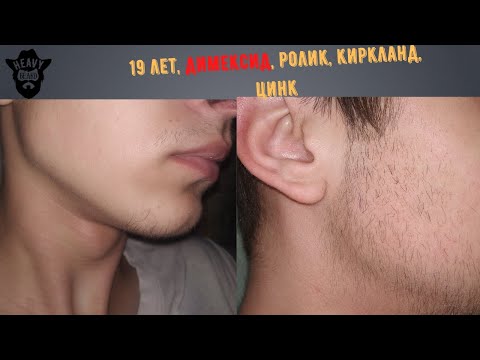 Видео: 19 лет, димексид + минокс Киркланд 5%