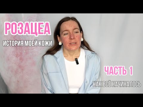 Видео: РОЗАЦЕА. ИСТОРИЯ МОЕЙ КОЖИ. ЧАСТЬ 1: КАК ВСЁ НАЧАЛОСЬ 