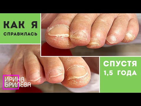 Видео: Перерыв 1,5 года!!! 🌸 Педикюр 🌸 Возрастные ноги 🌸 Ирина Брилёва