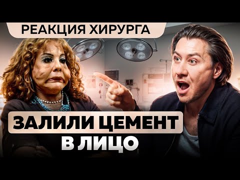 Видео: Пластический хирург В ШОКЕ: Залили ЦЕМЕНТ вместо филлеров В ЛИЦО!