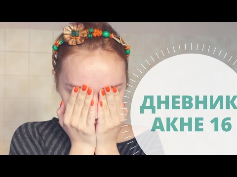 Видео: Дневник АКНЕкутана 16. Расходимся!