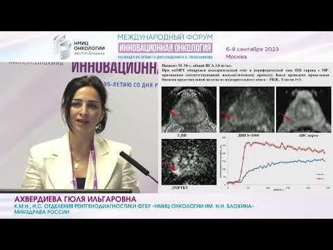 Видео: Мультипараметрическая МРТ в диагностике рака предстательной железы_Ахвердиева Г.И.