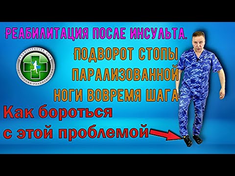 Видео: Подворот стопы при шаге парализованной ногой после инсульта - как исправить.