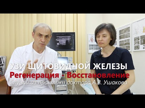 Видео: УЗИ щитовидной железы: Лечение и признаки восстановления (регенерации) щитовидной.  Доктор Ушаков