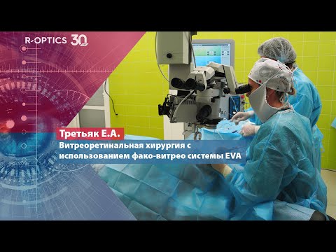 Видео: Витреоретинальная хирургия с использованием фако-витрео системы EVA (Третьяк Е.А.)