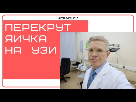 Видео: Перекрут яичка на УЗИ мошонки