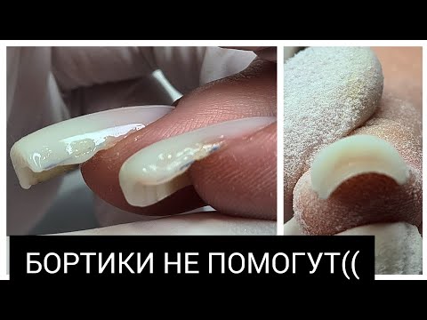 Видео: БОРТИКИ здесь НЕ ПОМОГУТ((((