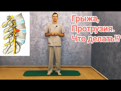 Видео: Грыжа, протрузия поясничного отдела позвоночника. Рекомендации