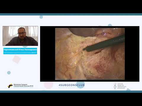 Видео: Черниковский - 2 и 3 тип нижнеампулярного рака. Смысл в интерсфинктерной резекции. За и против.