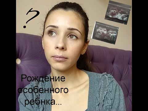 Видео: Рождение особенного ребенка/ Беременность с угрозами/ Расширенные желудочки ГМ у плода/ ВПР ЦНС