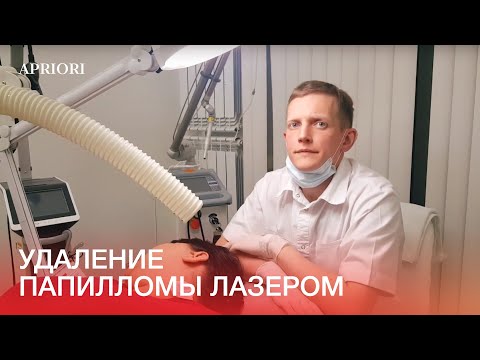 Видео: Удаление папилломы лазером в Дзержинске