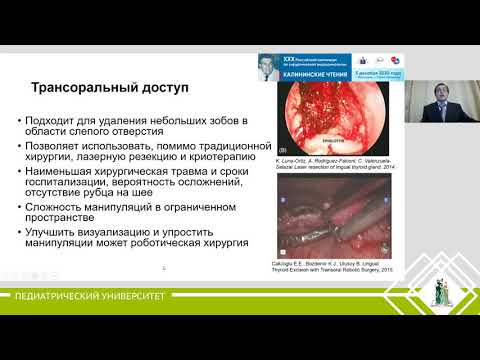 Видео: Карпатский И.В. ХИРУРГИЧЕСКОЕ ЛЕЧЕНИЕ БОЛЬНЫХ ДИСТОПИЕЙ ЗОБНОИЗМЕНЕННОЙ ЩИТОВИДНОЙ ЖЕЛЕЗЫ