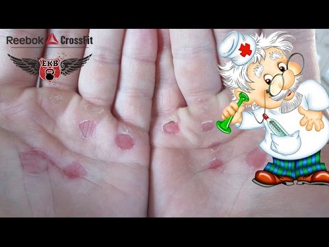 Видео: Защита рук. Накладки из пластыря. Part 2