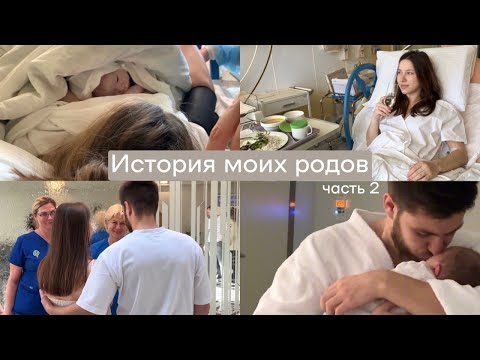 Видео: История моих родов: ощущения от эпидуральной анестезии, партнерские роды, первые дни с малышом :)