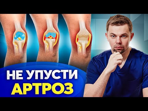 Видео: Вот, почему болит КОЛЕНО! Стадии артроза коленного сустава
